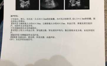 功能失调性子宫出血症