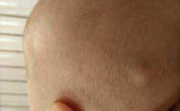 21号染色体参考值是多少~~试管代生官网