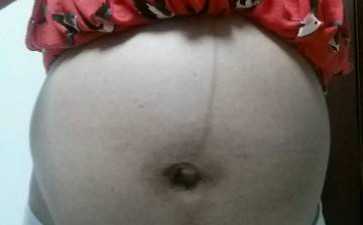 先兆子宫破裂的护理（子宫息肉影响生育吗）