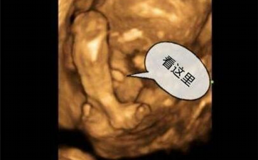 试管鲜肧移植成功后为什么会出现腹水？-助孕公司地址