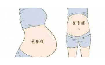 东莞代生专家,东莞市人民医院试管婴儿费用,2025单周期助孕省钱攻略