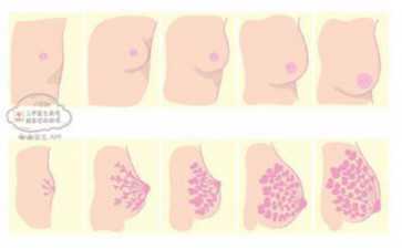 染色体异常的鉴别方法~~正规试管代怀