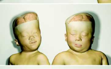 東莞哪家借卵生子機構好？正規供卵機構名單推薦