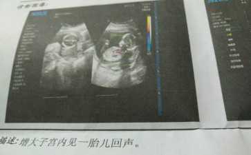 東莞哪家借卵生子機構好？正規供卵機構名單推薦